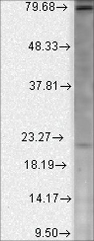 Monoclonal Anti-CACNB2 antibody produced in mouse