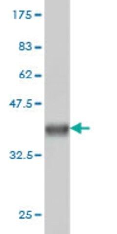 Monoclonal Anti-CABC1, (N-terminal) antibody produced in mouse