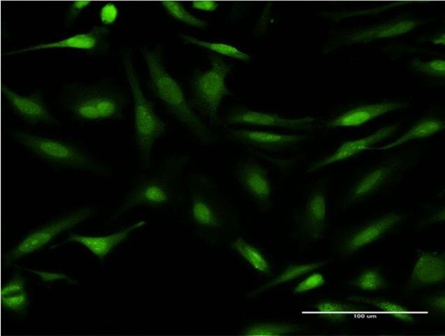 Monoclonal Anti-CALCOCO2, (C-terminal) antibody produced in mouse