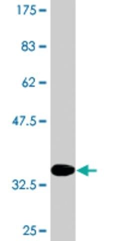 Monoclonal Anti-CALCR, (C-terminal) antibody produced in mouse