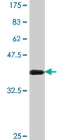 Monoclonal Anti-CABP4 antibody produced in mouse