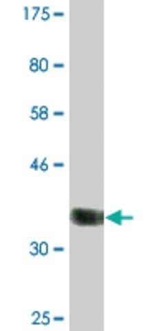 Monoclonal Anti-CABIN1, (N-terminal) antibody produced in mouse