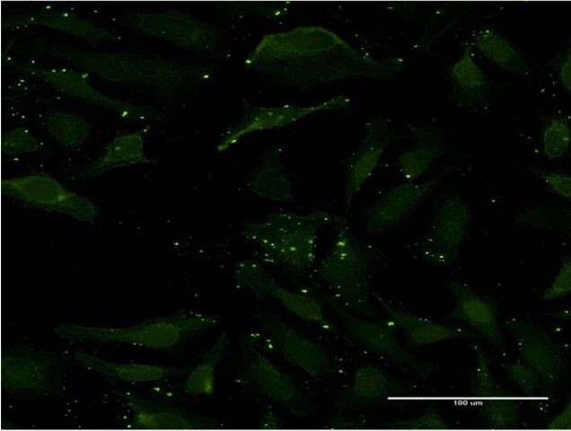 Monoclonal Anti-CCL17, (C-terminal) antibody produced in mouse