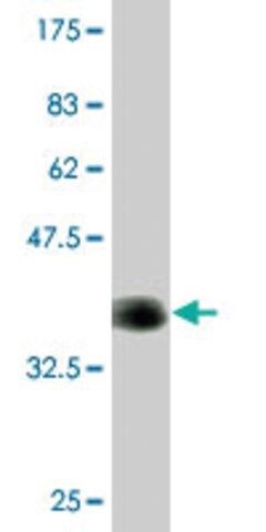 Monoclonal Anti-CACNA1F, (C-terminal) antibody produced in mouse