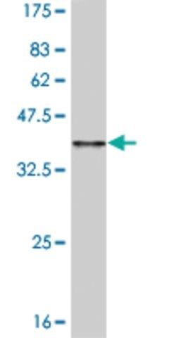 Monoclonal Anti-CCL15, (C-terminal) antibody produced in mouse