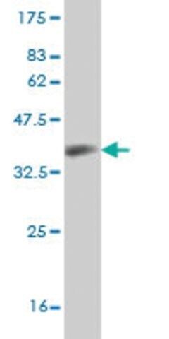 Monoclonal Anti-CCL14, (C-terminal) antibody produced in mouse