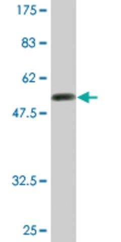 Monoclonal Anti-CENPH antibody produced in mouse