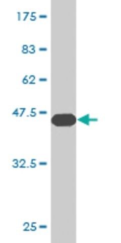 Monoclonal Anti-CGB5 antibody produced in mouse