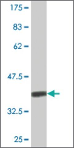 Monoclonal Anti-CENPK antibody produced in mouse