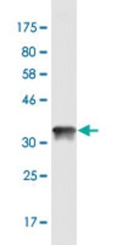 Monoclonal Anti-CGB, (C-terminal) antibody produced in mouse