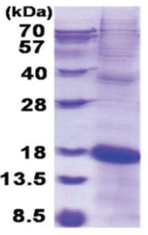 KLRC2 human