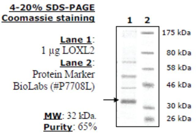 Lysyl Oxidase-like 2 (LOXL2) FLAG-tag (Sf9-derived) human