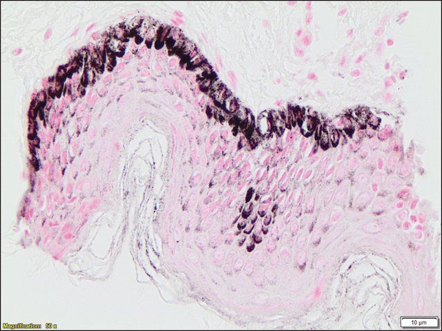 Melanin TISSUE-TROL<sup>TM</sup> Control Slides