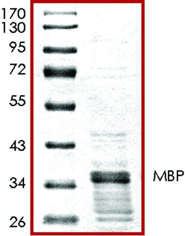 MBP, GST tagged human