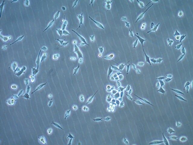 MB49 Mouse Bladder Carcinoma Cell Line