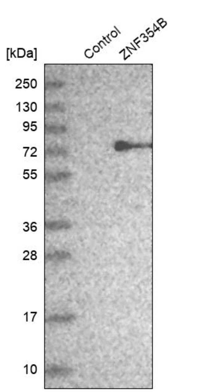 Anti-ZNF354B antibody produced in rabbit