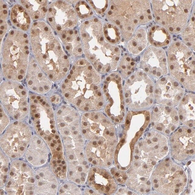 Anti-ZNF75A antibody produced in rabbit