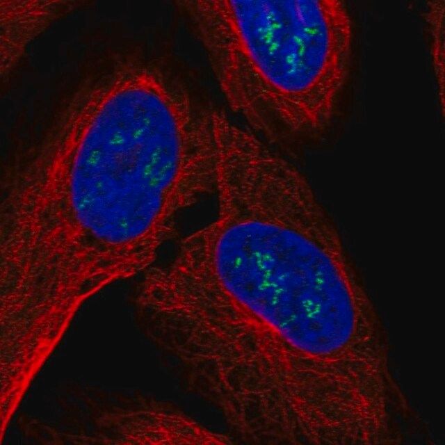 Anti-ZNF385B antibody produced in rabbit