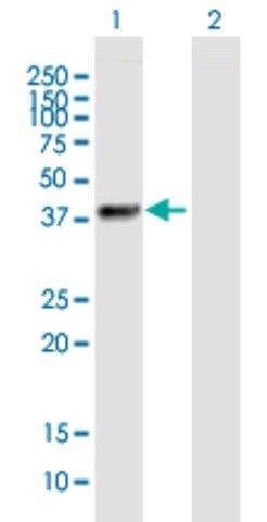 Anti-ZNF385B antibody produced in mouse