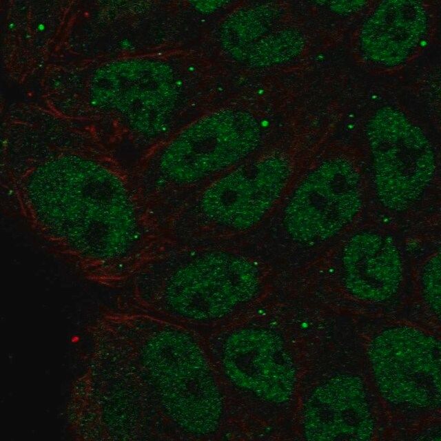 Anti-ZNF585B antibody produced in rabbit