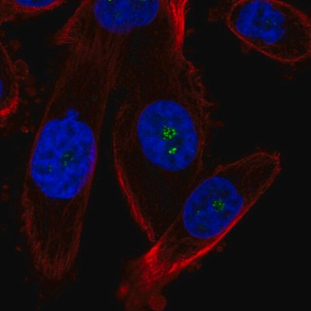 Anti-ZNRD1 antibody produced in rabbit