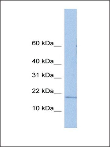 Anti-ZNHIT3 antibody produced in rabbit