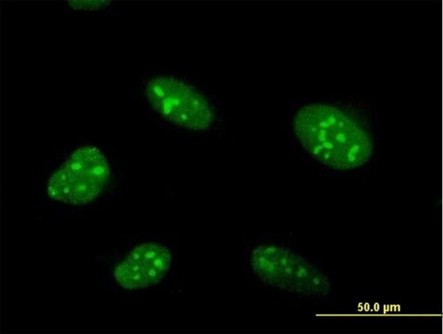 Anti-ZNF593 antibody produced in mouse