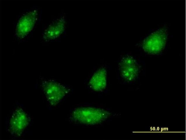 Anti-ZNF576 antibody produced in mouse