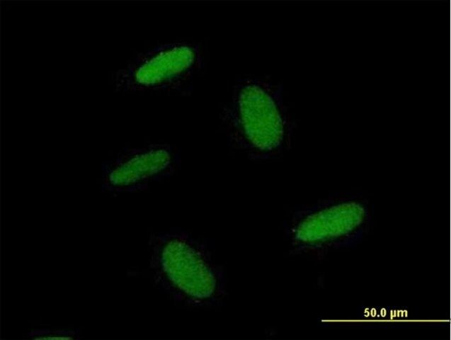 Anti-ZNF557 antibody produced in mouse