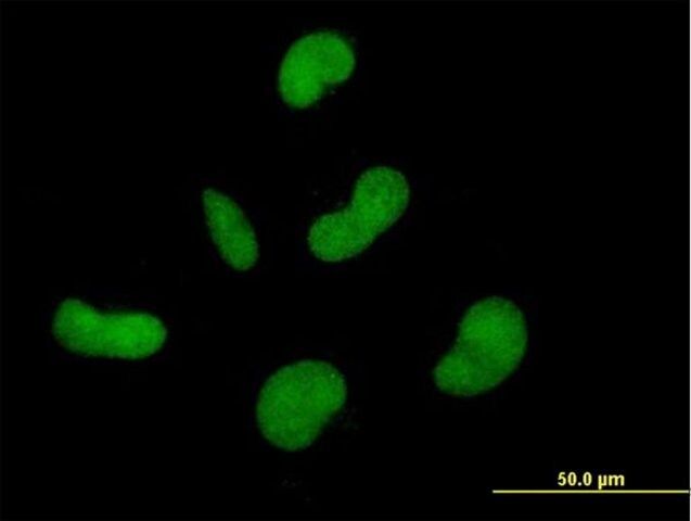 Anti-ZNF350 antibody produced in mouse