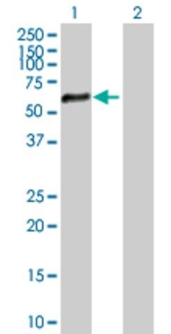 Anti-ZNF34 antibody produced in mouse