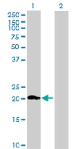 Anti-ZNF747 antibody produced in mouse