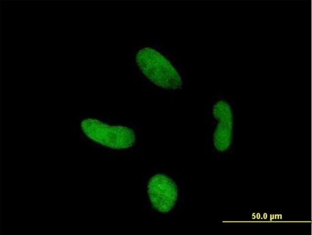 Anti-ZNF287 antibody produced in mouse