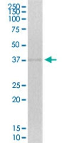 Anti-ZNF444 antibody produced in mouse