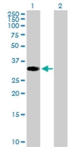 Anti-ZNF101 antibody produced in mouse