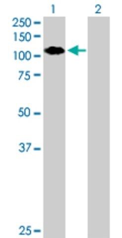 Anti-ZNF408 antibody produced in mouse