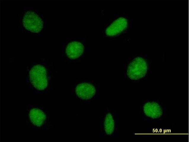 Anti-ZNF624 antibody produced in mouse