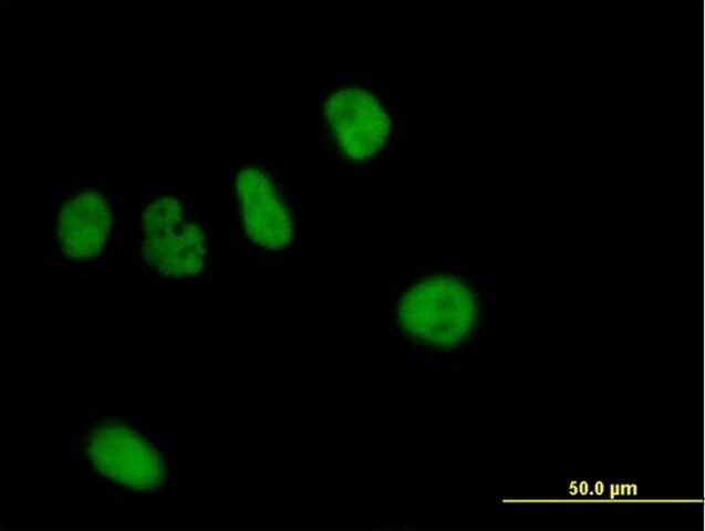 Anti-ZNF484 antibody produced in mouse