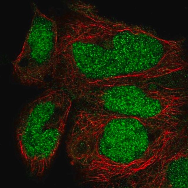 Anti-ZNF331 antibody produced in rabbit