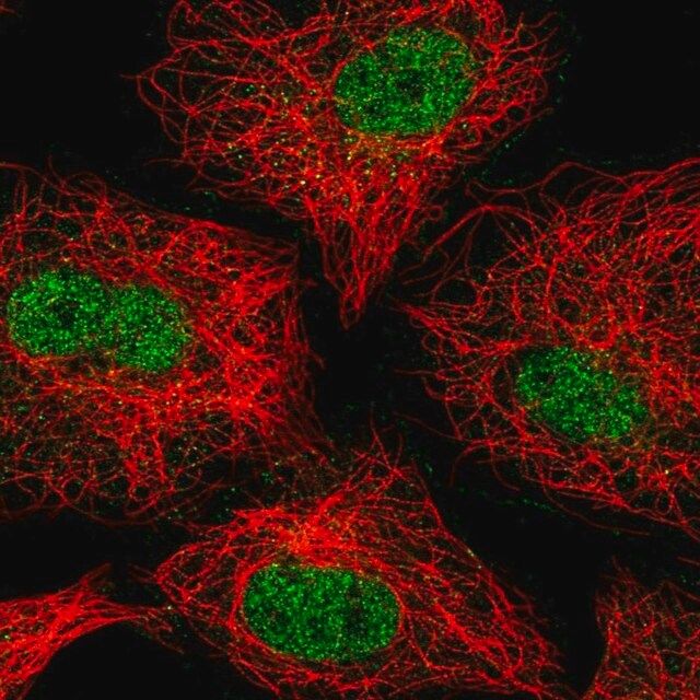 Anti-ZNF618 antibody produced in rabbit