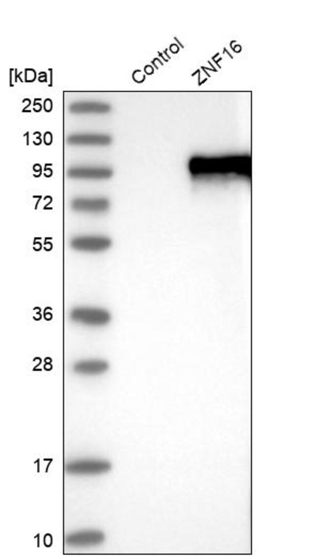 Anti-ZNF16 antibody produced in rabbit