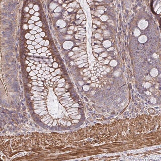 Anti-ZNF696 antibody produced in rabbit