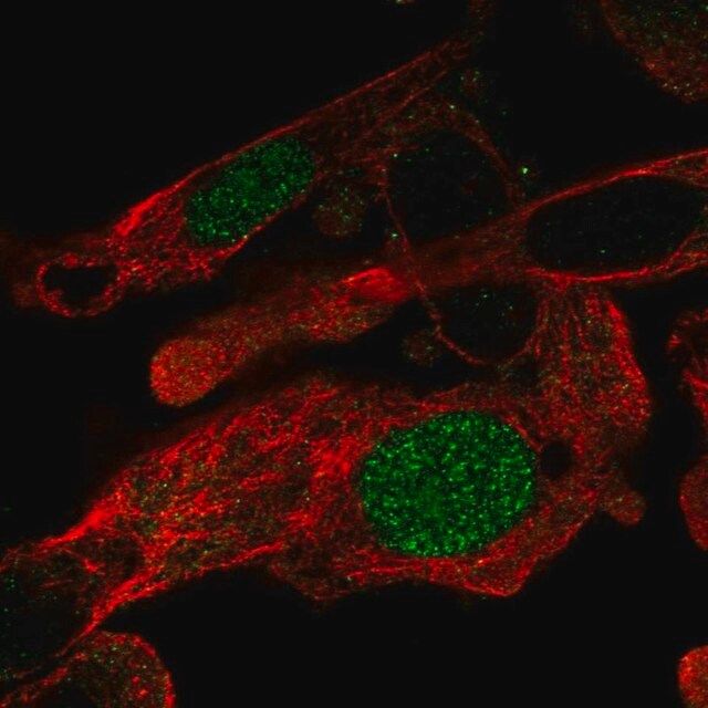 Anti-ZNF696 antibody produced in rabbit