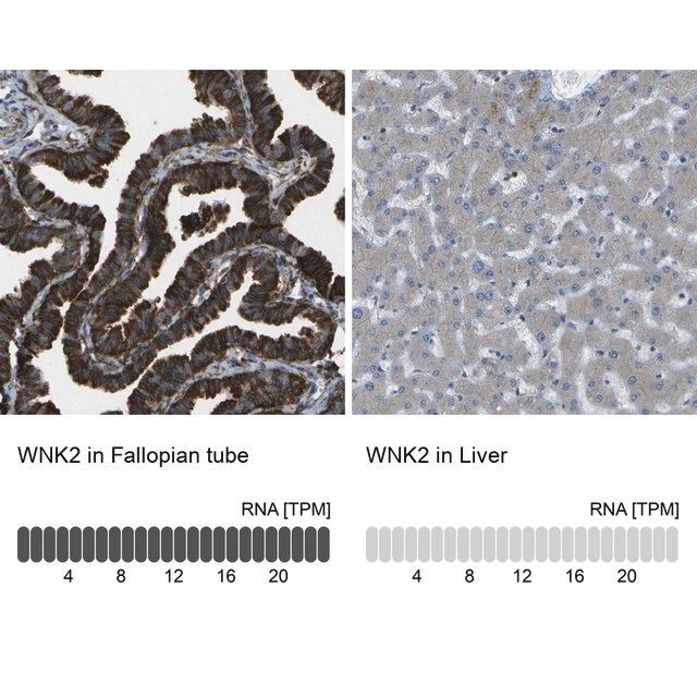 Anti-WNK2 antibody produced in rabbit