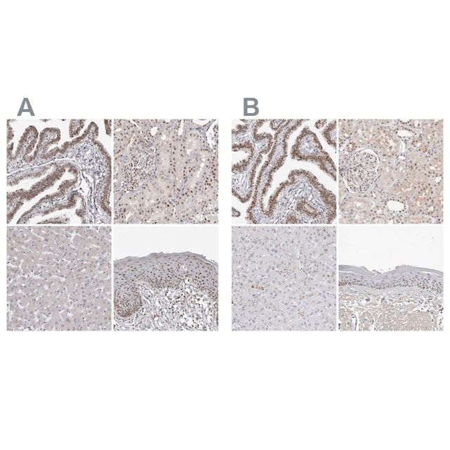 Anti-WRAP53 antibody produced in rabbit