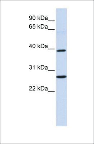 Anti-WNT16 antibody produced in rabbit