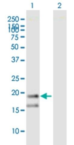 Anti-WRB antibody produced in mouse