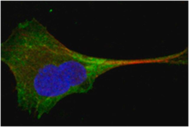 Anti-WNT10B Antibody, clone 5A7