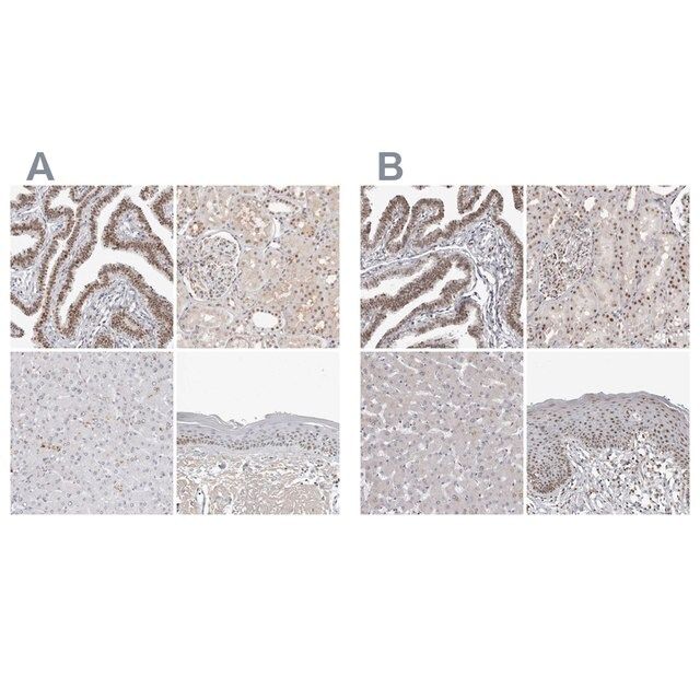 Anti-WRAP53 antibody produced in rabbit