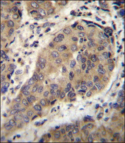 ANTI-WTIP (C-TERM) antibody produced in rabbit